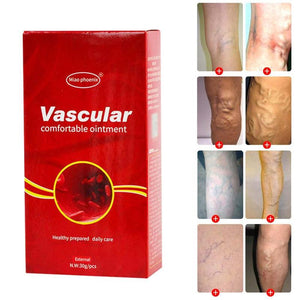 Varicose Veins Treatment Cream Vasculitis Phlebitis Pain Cream Angiitis Spider Removal Herbal Veins Treatment Remedy Varico S1D3